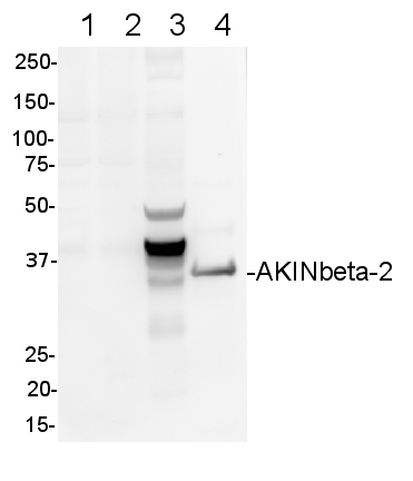 western blot detection using anti-AKINbeta-2 antibodies
